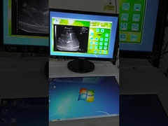 Fonte de onda fixa Ondas de choque extracorpóreas Máquina de litotripsia Sistema de localização por ultra-som