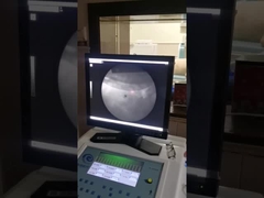 Máquina de ondas de choque extracorporal de alta precisão, sistema de raios X de litorípsia.